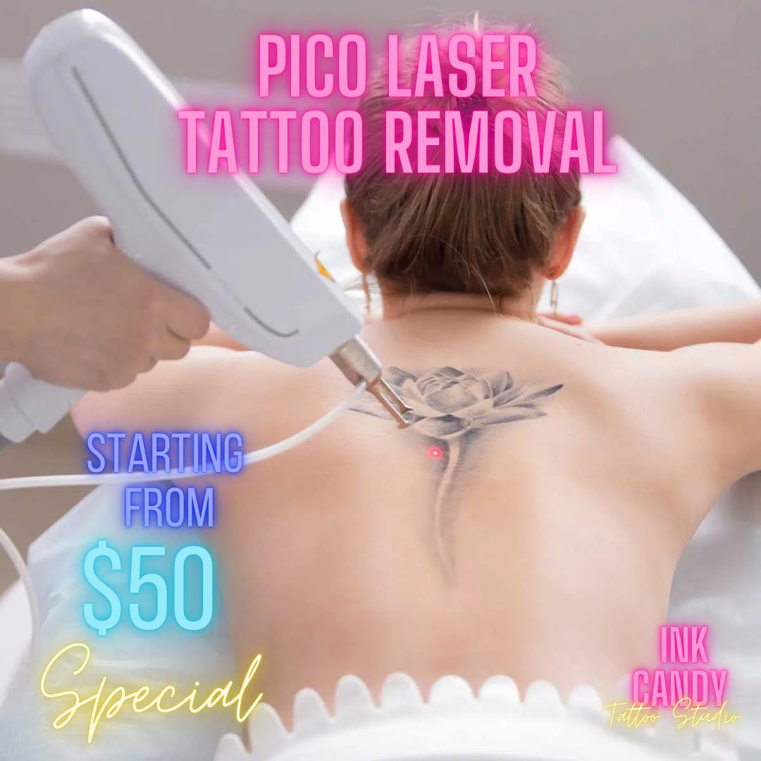 Tattoo Removal in North Sydney - Neutral Bay near Mosman, Manly, Dee Why,  Macquarie Park, Brookvale
